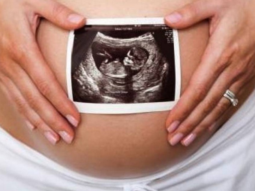  Attempting to Conceive? Train to Optimize Fertility